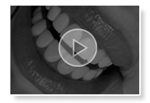 Dental Videos